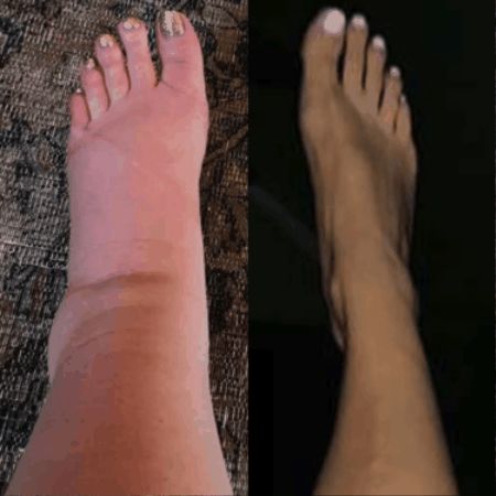 Lymphatic Drainage Drops