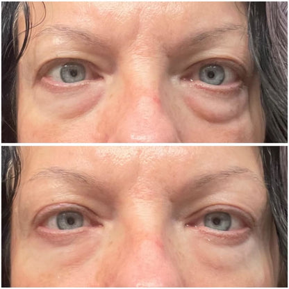 RestedGlow™: Bio-Collagen Eye Patches