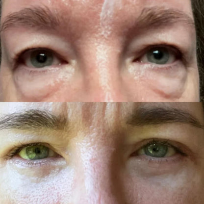 RestedGlow™: Bio-Collagen Eye Patches