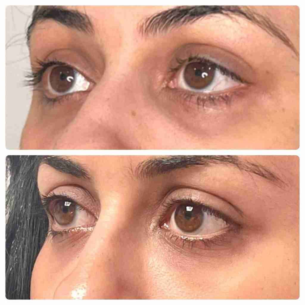 RestedGlow™: Bio-Collagen Eye Patches