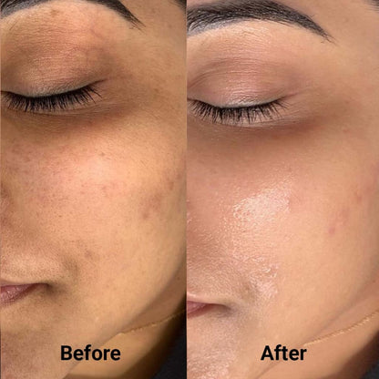 Korean Hyaluronic PDRN Orb Serum