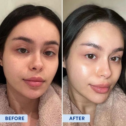 Korean Hyaluronic PDRN Orb Serum