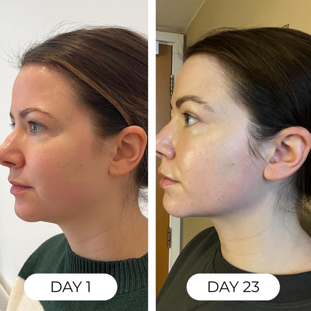 Lymphatic Drainage Drops