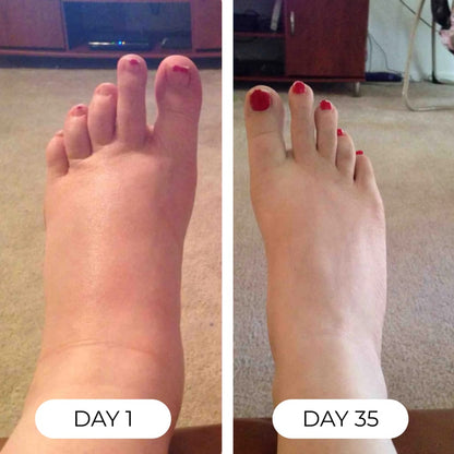 Lymphatic Drainage Drops