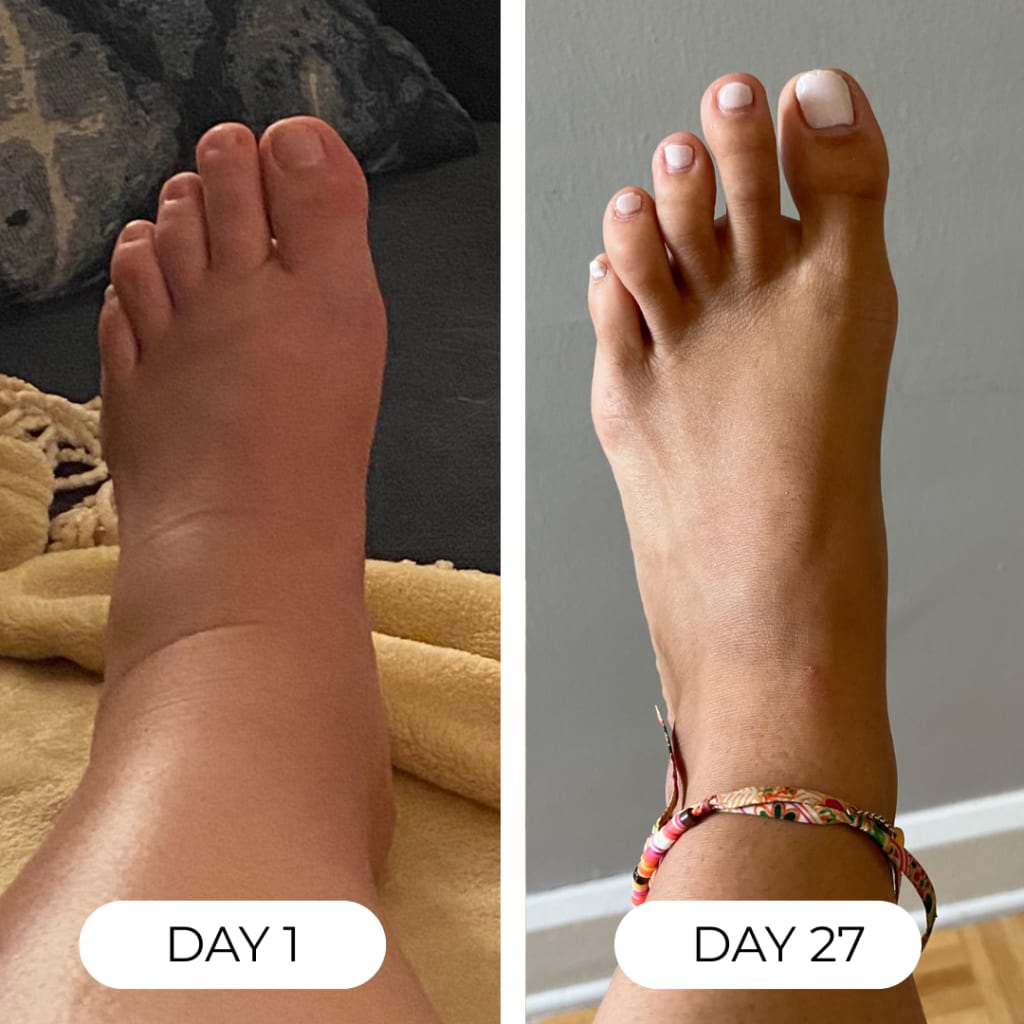 Lymphatic Drainage Drops