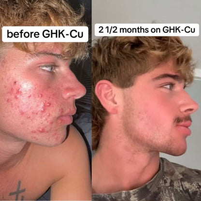 GHK-Cu Skin Repair Serum